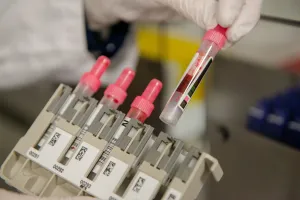 Stellvertretend Labor